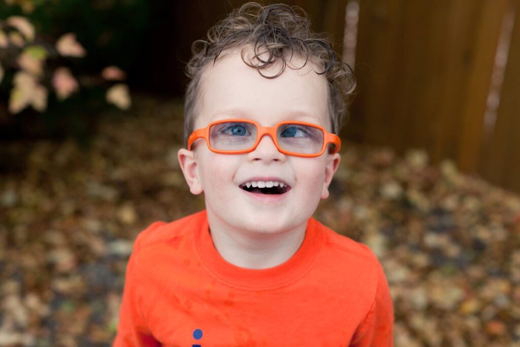 alternating esotropia boy with orange glasses